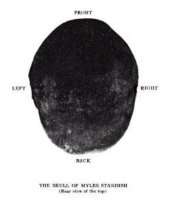 Myles Standish's skull discovered in the Standish gravesite at Myles Standish Burial Ground during an investigation of the grave